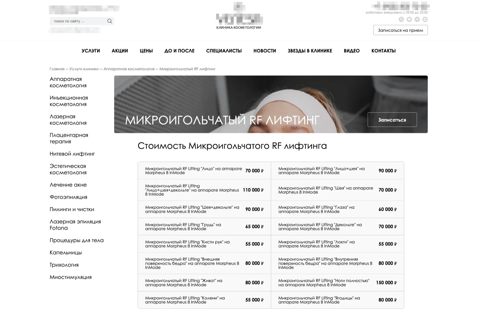 Таблица стоимости микроигольчатого RF-лифтинга по зонам с ценами от 55 до 150 тысяч рублей в начале страницы